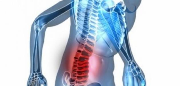 أسباب الانزلاق الغضروفي. تعرف على مراكز علاج الانزلاق الغضروفي في تركيا