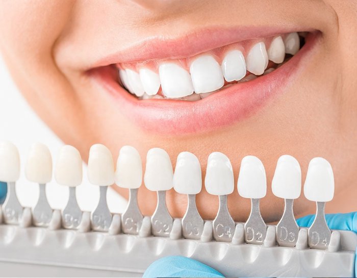 زراعة الاسنان في تركيا وتكلفتها تعرف على أهمية زراعة الأسنان في تركيا