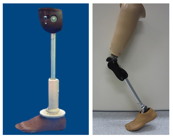 مجرىات ومدة عملية تغيير مفصل الركبة