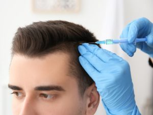 تقنية السفير لزراعة الشعر