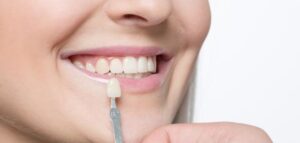 عروض تركيب الاسنان في تركيا
